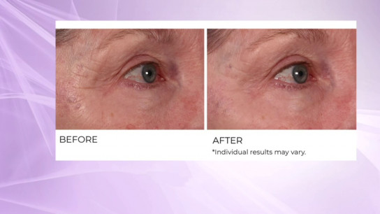 Dermaflect Day Therapy Serum 30ml NassifMD
