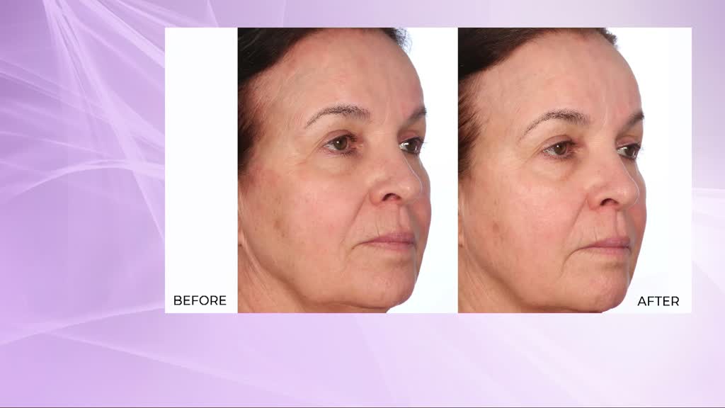 NassifMD Skincare
